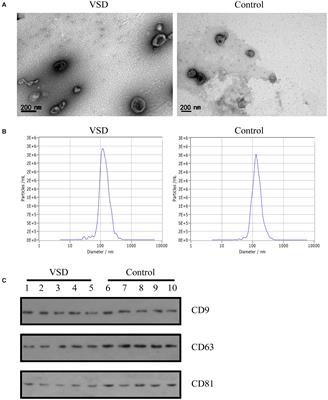 Maternal Circulating Exosomal miRNAs as Non-invasive Biomarkers for the Prediction of Fetal Ventricular Septal Defect